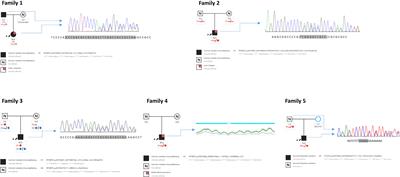 Novel frameshift variants expand the map of the genetic defects in IRF2BP2